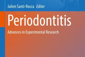 [springer]牙周炎 | Periodontitis