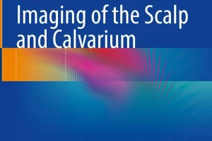 [springer]头皮和颅骨成像 | Imaging of the Scalp and Calvarium
